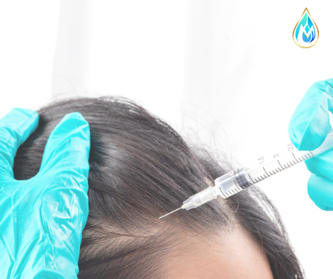 Plasma rico en plaquetas capilar